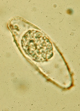 Oocyst of Isospora Belli Oocyst of Isospora Belli