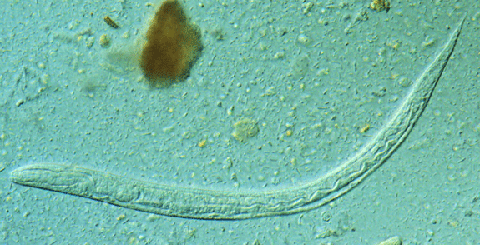 Strongyloides larva Strongyloides larva